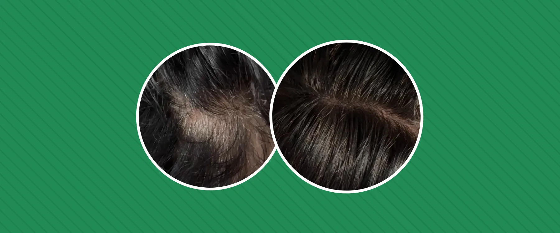Gray Hair Concealing Set